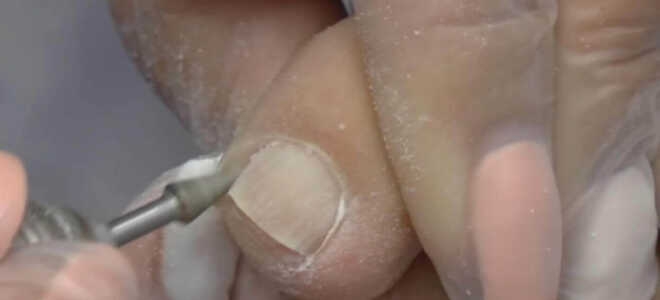 10 ошибок при выполнении аппаратного педикюра