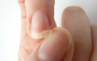 Гайд по диагностике заболевания ногтей — определяем и лечим