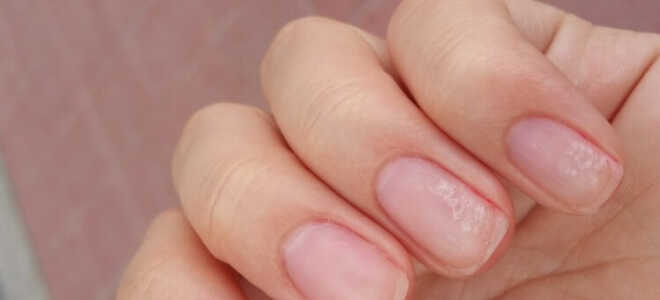Здоровье ногтей — от чего зависит, как влияет маникюр