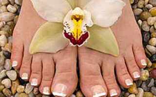 Натоптыши на ногах лечение