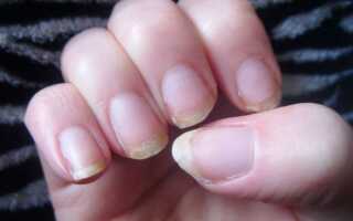 Как сохранить здоровье ногтей во время беременности
