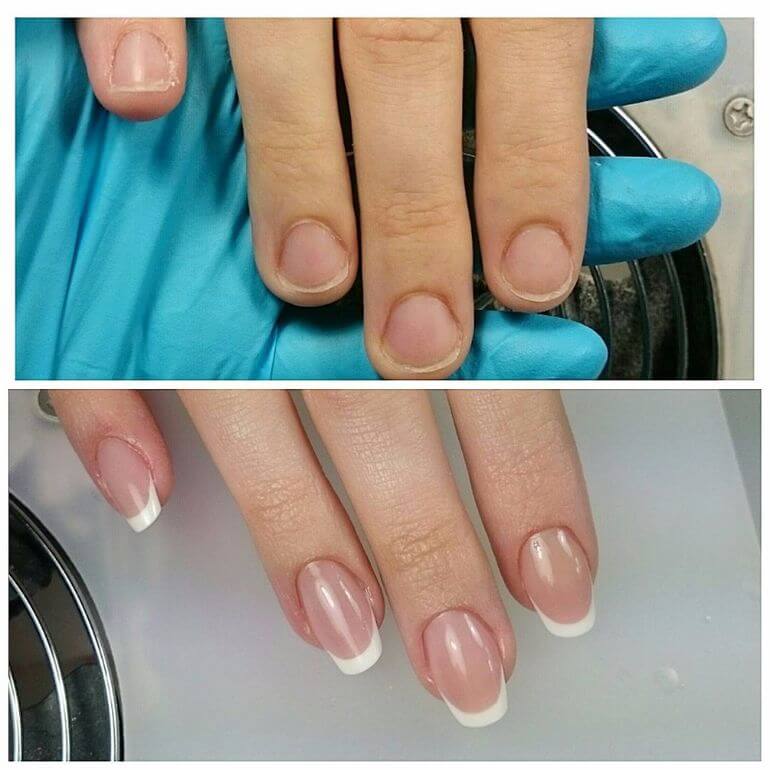 Пример наращивания акрилом