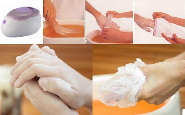 Этапы выполнения парафинотерапии