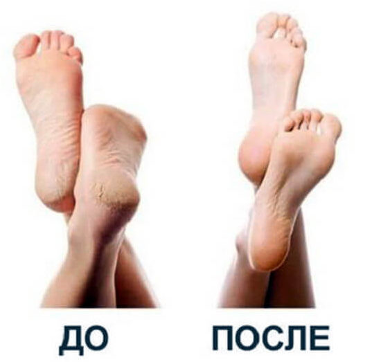 Эффект от аквапилинга