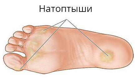 Правила применения средства