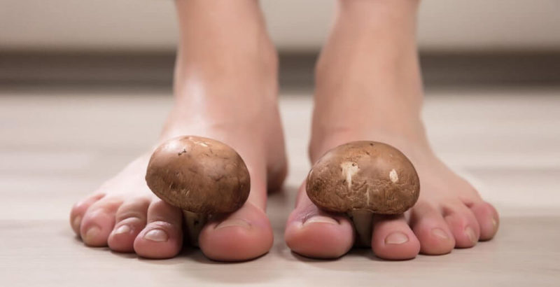 Лечение онихомикоза медицинским педикюром