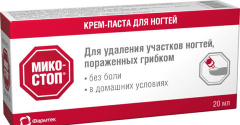 Крем-паста Микостоп для удаления участков пораженных грибком