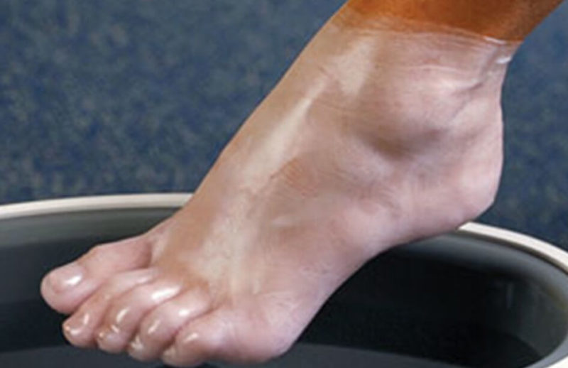 Рекомендуемая периодичность парафинотерапии для ног