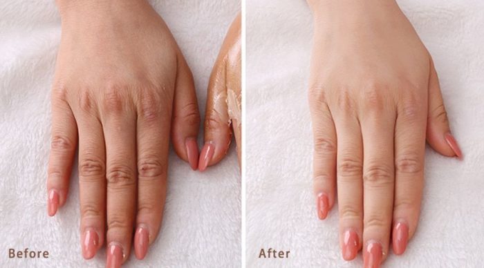 Руки до и после парафинотерапии