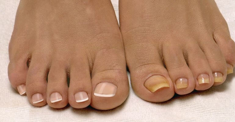 Как ухаживать за ногтями летом