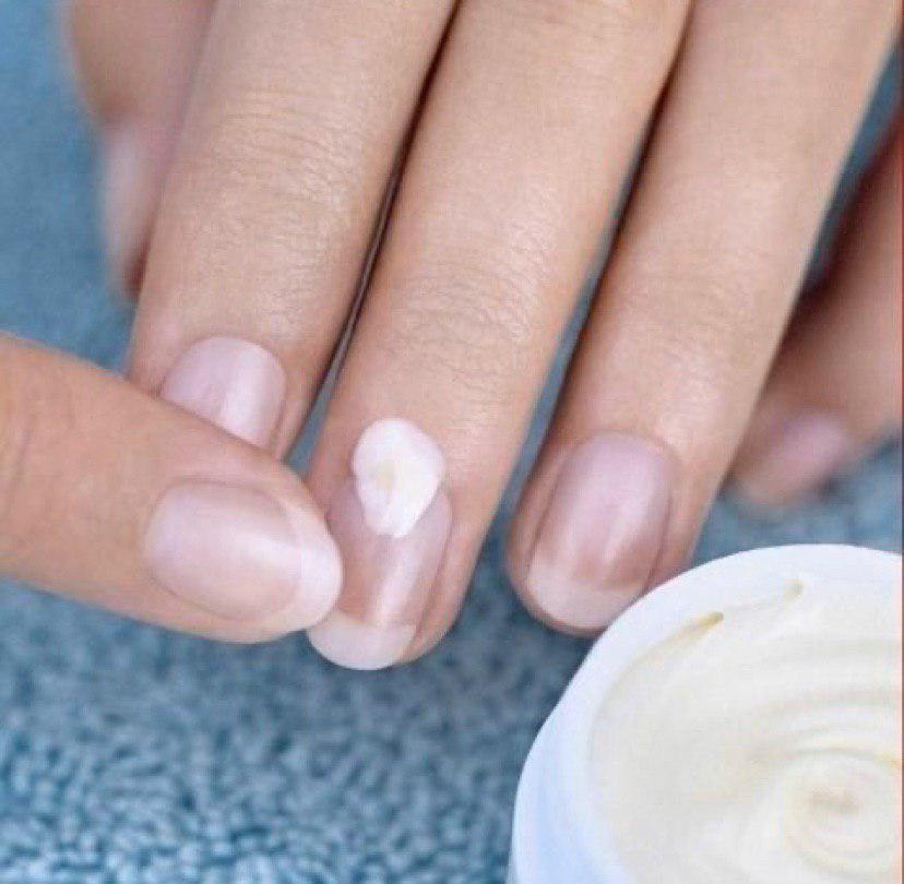 правильный уход за ногтевой пластиной