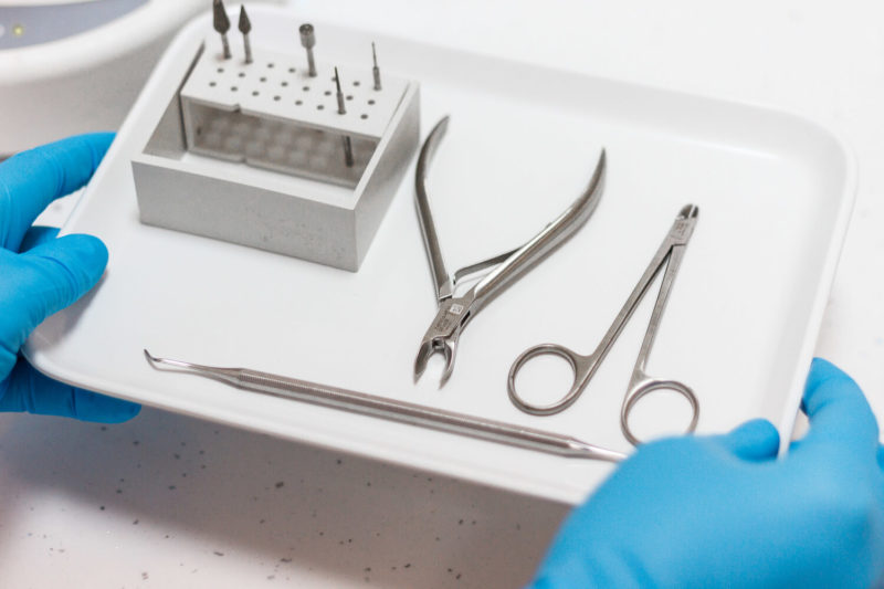 Процедура лечения деформированного ногтя