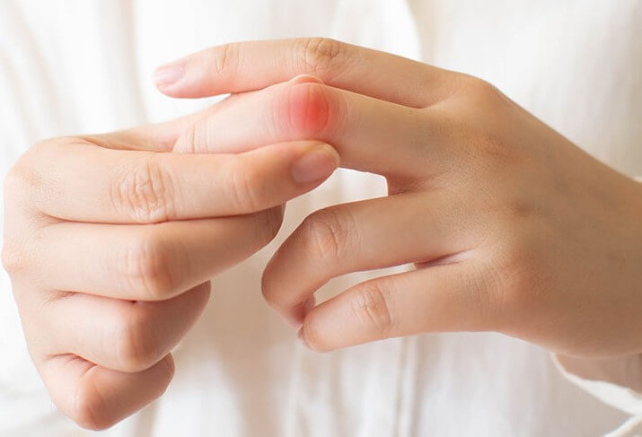 Противопоказания для массажа рук в маникюре