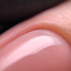 Птеригий - причина отслоек