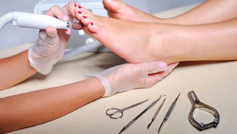 Шлифовка стопы при гиперкератозе