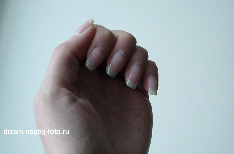 отремонтированный ноготь