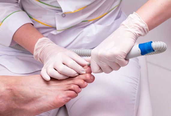 Вросший ноготь лечение хирургия