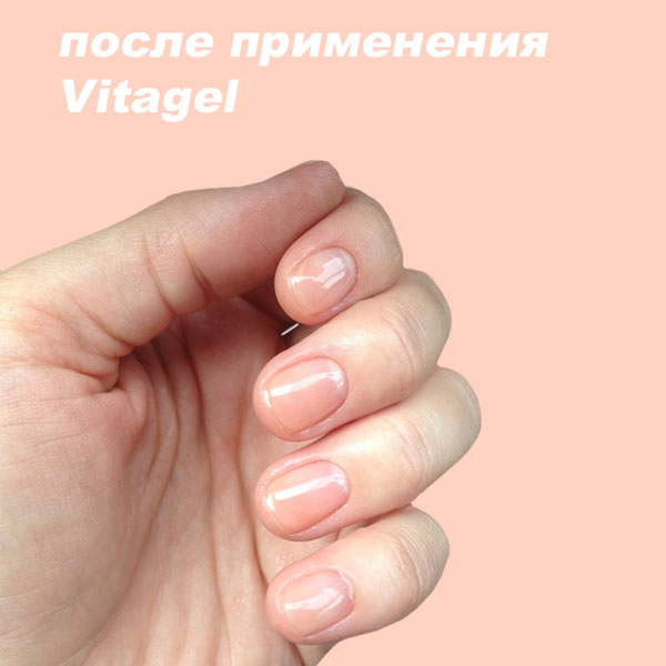VitaGel после применения - фотография